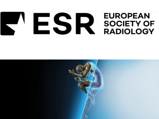 ECR